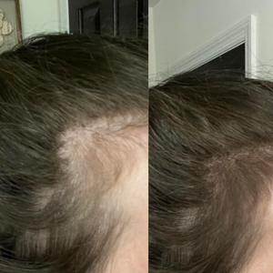 Beige Minimalist Skincare Before and After Instagram Post (3).png