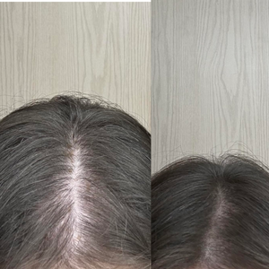 Beige Minimalist Skincare Before and After Instagram Post (4).png