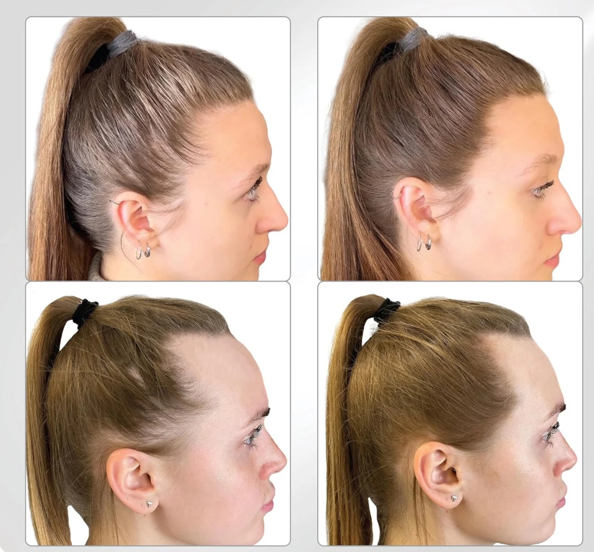 Pudră Păr THICK FIBER pentru mascarea părului cărunt și rar