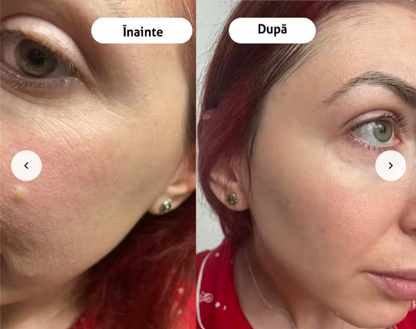 Kuryna - Set Microinfuzie cu Aur 24K