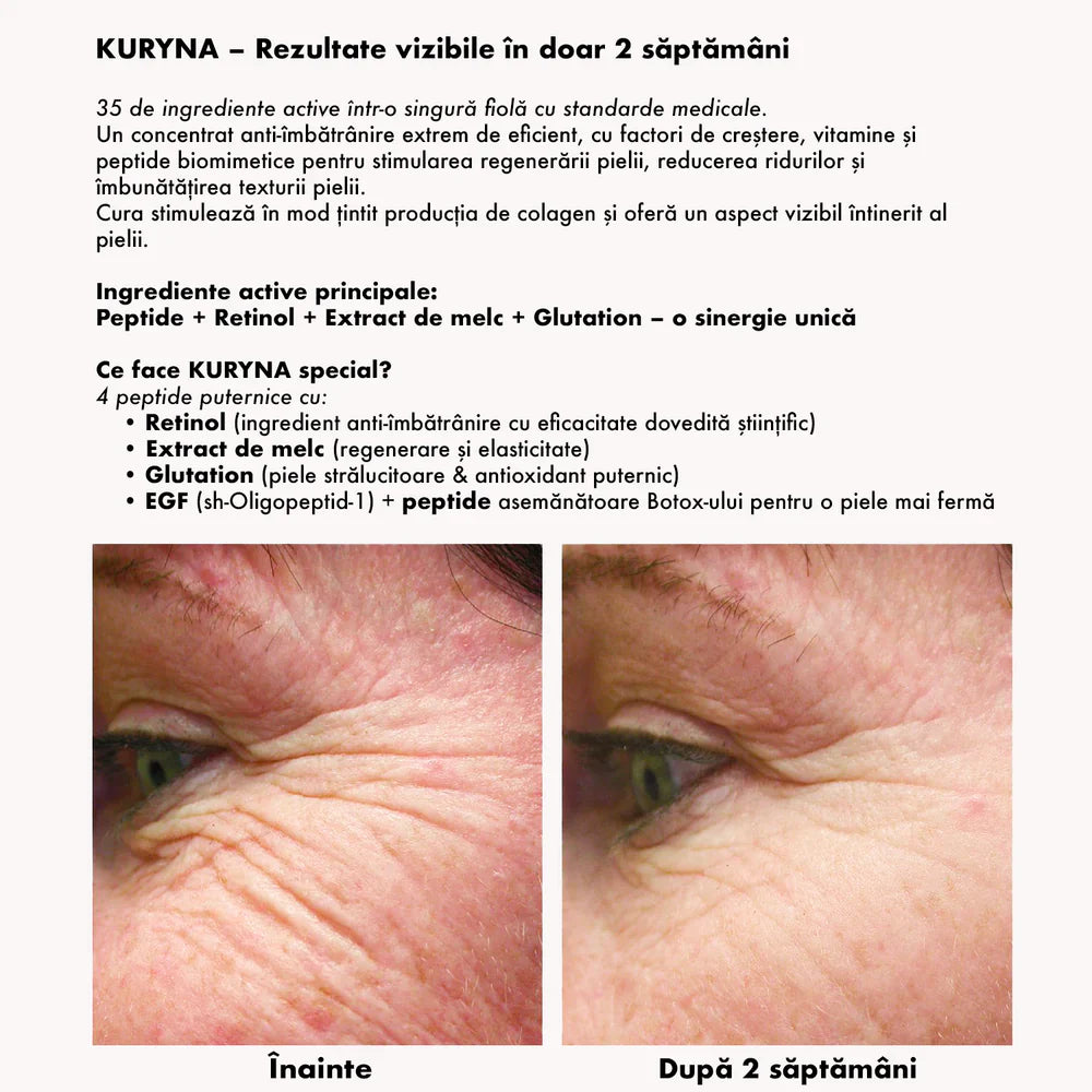 Kuryna - Set Microinfuzie cu Aur 24K